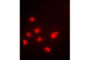 Immunofluorescent analysis of p63 staining in A549 cells. (TCP1 alpha/CCTA Antikörper  (C-Term))
