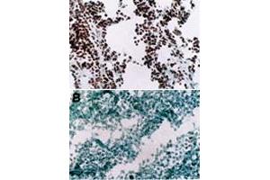 Immunohistochemistry (Frozen sections) using Myod1 monoclonal antibody, clone 5. (MYOD1 Antikörper  (AA 180-189))