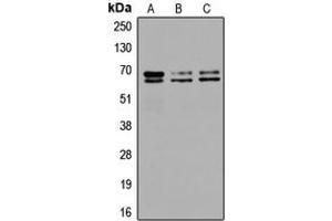 Western blot analysis of GAD1/2 expression in SKNSH (A), SP2/0 (B), PC12 (C) whole cell lysates. (GAD65+GAD67 (C-Term) Antikörper)