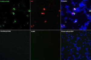 Immunofluorescence analysis of 293T cells transfected with mCherry-Tag fusion protein and untreated 293T cells use Mouse anti mCherry-Tag mAb (ABIN7268432) at dilution of 1:100 (40x lens). (mCherry Antikörper)