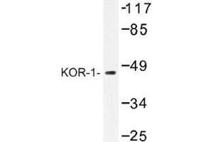 Image no. 1 for anti-Opioid Receptor, kappa 1 (OPRK1) antibody (ABIN317765) (OPRK1 Antikörper)