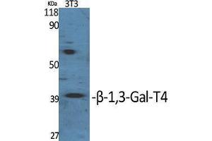 Western Blotting (WB) image for anti-UDP-Gal:betaGlcNAc beta 1,3-Galactosyltransferase, Polypeptide 4 (B3GALT4) (Internal Region) antibody (ABIN3180957)