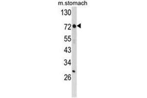 Western blot analysis of ZFP36 Antibody (ZNF823 Antikörper  (Middle Region))