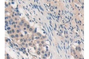 Immunohistochemistry (IHC) image for anti-Matrix Metallopeptidase 19 (MMP19) (AA 98-508) antibody (ABIN7434200)