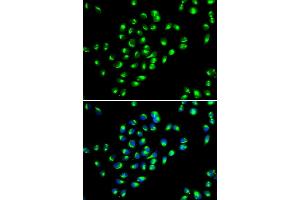 Immunofluorescence analysis of MCF-7 cells using GOLM1 antibody.