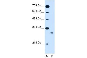 WB Suggested Anti-SLC25A22  Antibody Titration: 1. (SLC25A22 Antikörper  (N-Term))