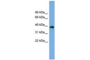 Image no. 1 for anti-Death Effector Domain Containing 2 (DEDD2) (AA 179-228) antibody (ABIN6744979) (DEDD2 Antikörper  (AA 179-228))