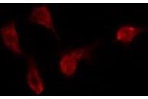 ABIN6275417 staining Hela by IF/ICC. (DYRK3 Antikörper)