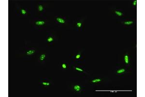 Immunofluorescence of purified MaxPab antibody to ADAR on HeLa cell. (ADAR Antikörper  (AA 1-1226))
