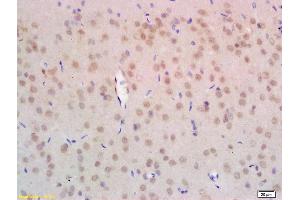 Formalin-fixed and paraffin embedded rat brain labeled with Anti-NPD014 Polyclonal Antibody, Unconjugated (ABIN1386775) at 1:200 followed by conjugation to the secondary antibody and DAB staining. (C1orf63 Antikörper  (AA 4-100))