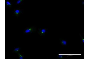 Immunofluorescence of monoclonal antibody to ACBD3 on HeLa cell. (ACBD3 Antikörper  (AA 73-171))