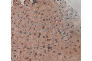 IHC-P analysis of liver tissue, with DAB staining. (TNP1 Antikörper  (AA 3-53))