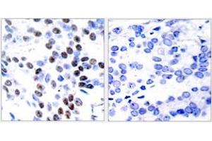 Immunohistochemistry (IHC) image for anti-Jun Proto-Oncogene (JUN) (AA 61-110) antibody (ABIN2889016) (C-JUN Antikörper  (AA 61-110))