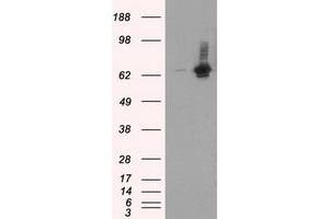 Western Blotting (WB) image for anti-RalA Binding Protein 1 (RALBP1) antibody (ABIN1500587) (RALBP1 Antikörper)