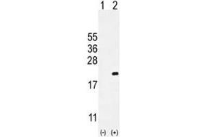 Western Blotting (WB) image for anti-Cyclin-Dependent Kinase Inhibitor 2C (p18, Inhibits CDK4) (CDKN2C) (AA 113-139) antibody (ABIN3030649)