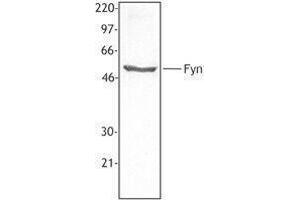 Western Blotting (WB) image for anti-FYN Oncogene Related To SRC, FGR, YES (FYN) antibody (ABIN2666047) (FYN Antikörper)