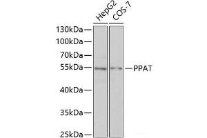 Western blot analysis of extracts of various cell lines using PPAT Polyclonal Antibody at dilution of 1:1000.