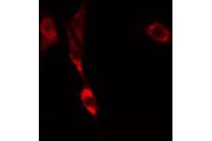 ABIN6274817 staining COLO205 cells by IF/ICC. (ARF6 Antikörper  (Internal Region))