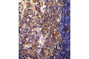 His6-DEP-1 Antibody immunohistochemistry analysis in formalin fixed and paraffin embedded human tonsil tissue followed by peroxidase conjugation of the secondary antibody and DAB staining. (PTPRJ Antikörper  (His6))