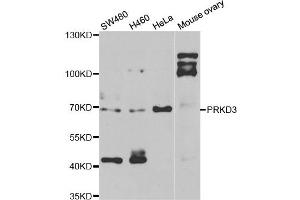 Western blot analysis of extracts of various cell lines, using PRKD3 antibody. (PRKD3 Antikörper)