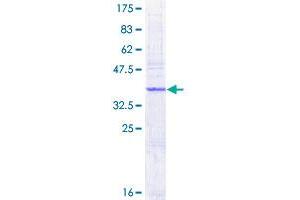 AP1S1 Protein (AA 1-133) (GST tag)