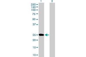 Western Blot analysis of DUSP19 expression in transfected 293T cell line by DUSP19 MaxPab polyclonal antibody. (DUSP19 Antikörper  (AA 1-217))