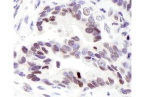 Immunohistochemistry (IHC) image for anti-PYD (Pyrin Domain) Containing 1 (PYDC1) (C-Term) antibody (ABIN7448421) (PYDC1 Antikörper  (C-Term))
