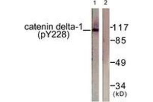 Western blot analysis of extracts from HuvEc cells, using Catenin-delta1 (Phospho-Tyr228) Antibody. (CTNND1 Antikörper  (pTyr228))