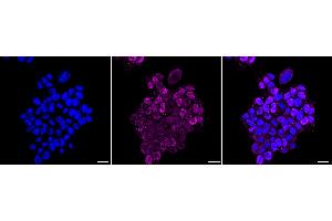 anti-E2F Transcription Factor 2 (E2F2) antibody