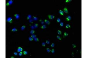 Immunofluorescence staining of Hela cells with ABIN7170052 at 1:160, counter-stained with DAPI.