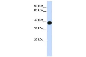 Western Blotting (WB) image for anti-Sphingolipid Delta(4)-Desaturase DES1 (DEGS1) antibody (ABIN2458939) (DEGS1 Antikörper)