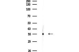 anti-Aldolase C, Fructose-Bisphosphate (ALDOC) (C-Term) antibody