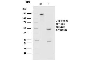 SDS-PAGE Analysis of Purified PD1 (CD279) Mouse Monoclonal Antibody (PDCD1/2720). (PD-1 Antikörper)