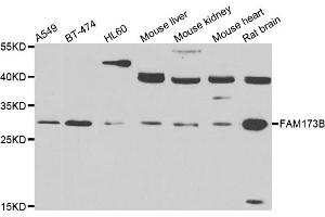 Western blot analysis of extracts of various cell lines, using FAM173B antibody (ABIN5975137) at 1/1000 dilution. (FAM173B Antikörper)