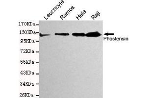 Western blot detection of Phostensin in Hela,Raji,Ramos and Leucocyte cell lysates and using Phostensin mouse mAb (1:200 diluted). (KIAA1949 Antikörper)