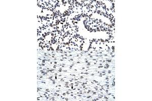 Immunohistochemical staining (Formalin-fixed paraffin-embedded sections) of (A) human lung and (B) human heart tissues with LHX3 polyclonal antibody . (LHX3 Antikörper  (Internal Region))