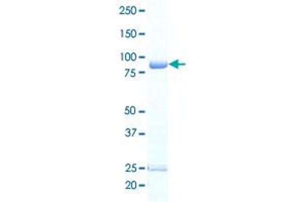 CAMKK1 Protein (AA 1-505) (GST tag)