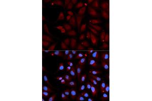 Immunofluorescence analysis of U2OS cell using MAOB antibody. (Monoamine Oxidase B Antikörper  (AA 1-260))