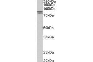 AP31777PU-N CDH1 antibody staining of Human kidney lysate at 0.