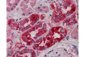 Image no. 1 for anti-Midline 2 (MID2) (C-Term) antibody (ABIN374299) (Midline 2 Antikörper  (C-Term))