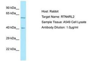 Image no. 1 for anti-Reticulon 4 Receptor-Like 2 (RTN4RL2) (C-Term) antibody (ABIN6750022) (RTN4RL2 Antikörper  (C-Term))