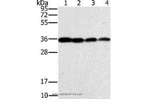 Western blot analysis of Raji, Jurkat, 293T and hela cell, using CENPV Polyclonal Antibody at dilution of 1:200 (CENPV Antikörper)