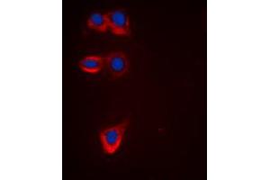 Immunofluorescent analysis of BCL2 staining in HeLa cells. (Bcl-2 Antikörper  (Center))