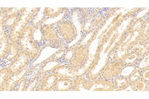 Detection of CASP3 in Human Kidney Tissue using Polyclonal Antibody to Caspase 3 (CASP3)