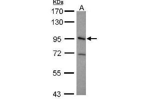 WB Image Sample (30 ug of whole cell lysate) A: HeLa 7. (Integrin beta 5 Antikörper  (Center))