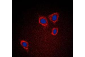 Immunofluorescent analysis of Caveolin 1 staining in A431 cells. (Caveolin-1 Antikörper  (C-Term))