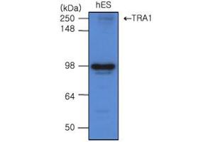 Western Blotting (WB) image for anti-Heat Shock Protein 90kDa beta (Grp94), Member 1 (HSP90B1) (AA 676-803) antibody (ABIN317570) (GRP94 Antikörper  (AA 676-803))