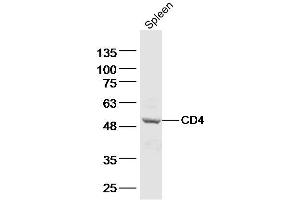 Mouse spleen lysates probed with CD4 Polyclonal Antibody, Unconjugated  at 1:500 dilution and 4˚C overnight incubation. (CD4 Antikörper  (AA 231-330))