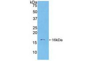 Detection of Recombinant S100A6, Human using Polyclonal Antibody to S100 Calcium Binding Protein A6 (S100A6) (S100A6 Antikörper  (AA 1-90))
