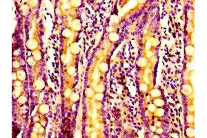 Immunohistochemistry of paraffin-embedded human small intestine tissue using ABIN7143085 at dilution of 1:100 (ARPC2 Antikörper  (AA 1-250))